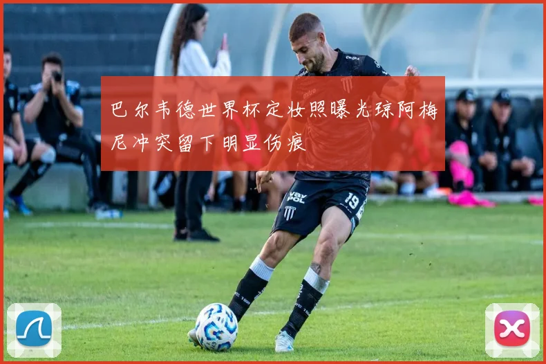 巴尔韦德世界杯定妆照曝光琼阿梅尼冲突留下明显伤痕